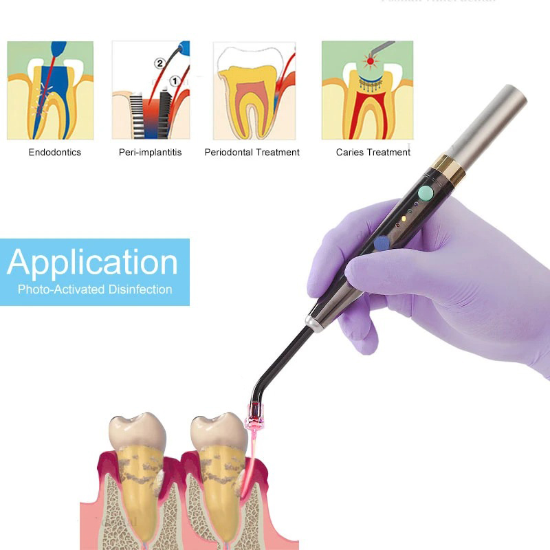Wireless F3WW Dental Diode Las - Photography Lighting Equipment ulasan dan harga